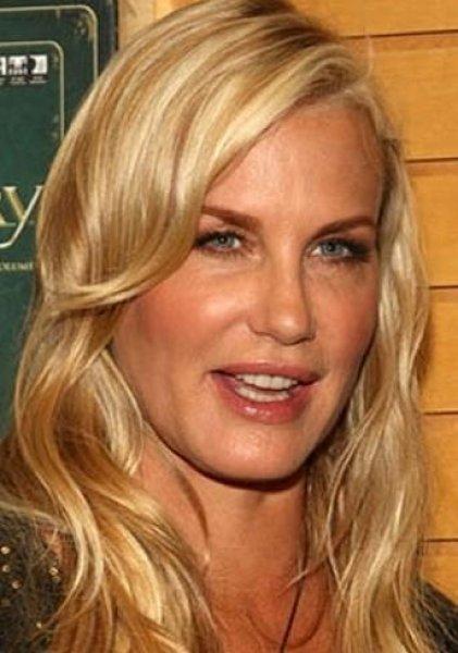 Estetik faciası ünlüler