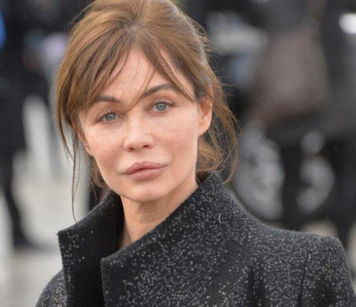 Estetik faciası ünlüler