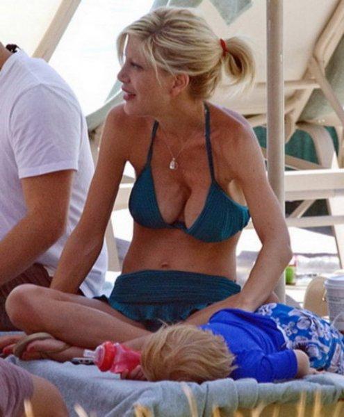 Estetik faciası ünlüler