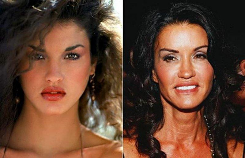 Estetik faciası ünlüler