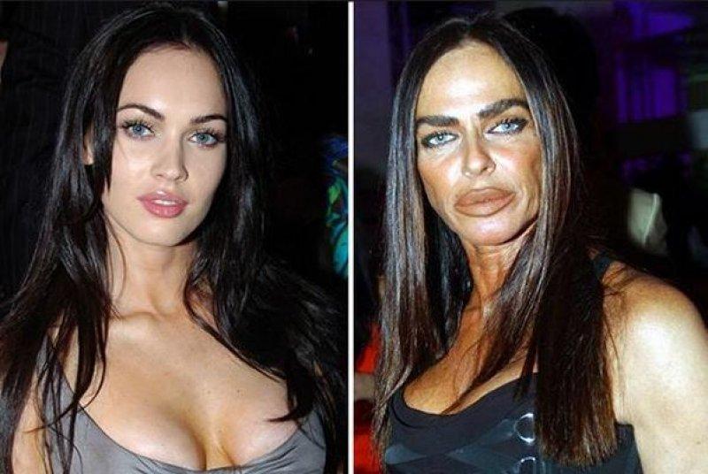 Estetik faciası ünlüler