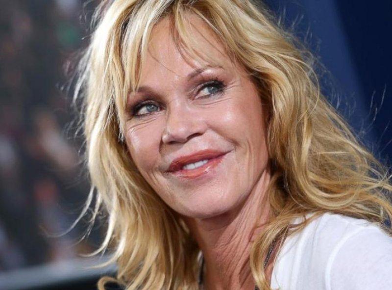 Estetik faciası ünlüler