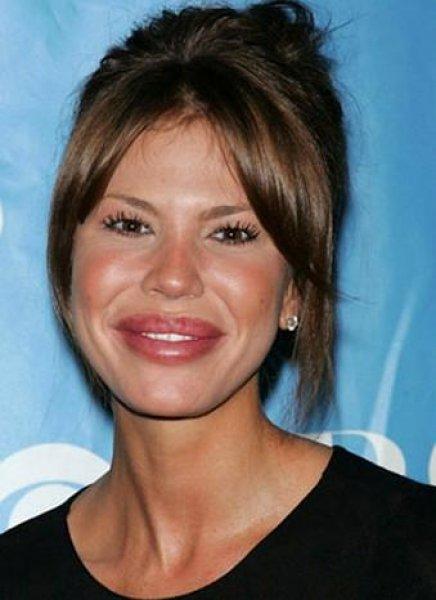 Estetik faciası ünlüler