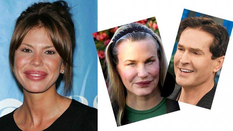 Estetik faciası ünlüler