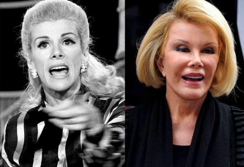 Estetik faciası ünlüler