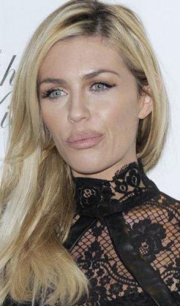 Estetik faciası ünlüler