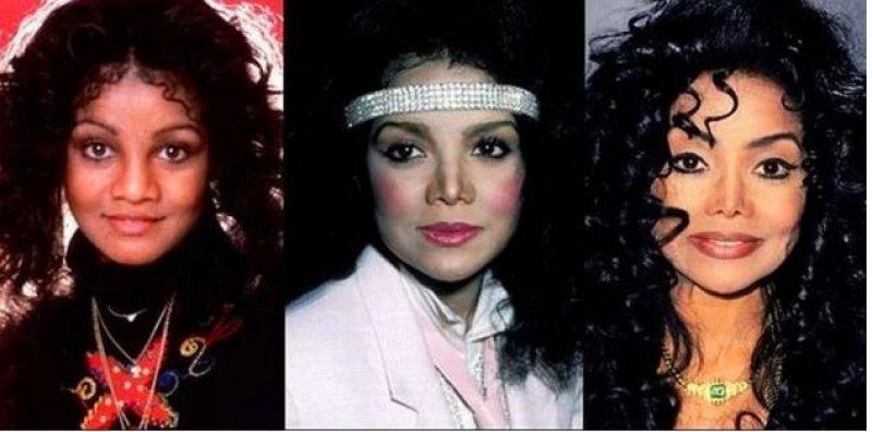 Estetik faciası ünlüler