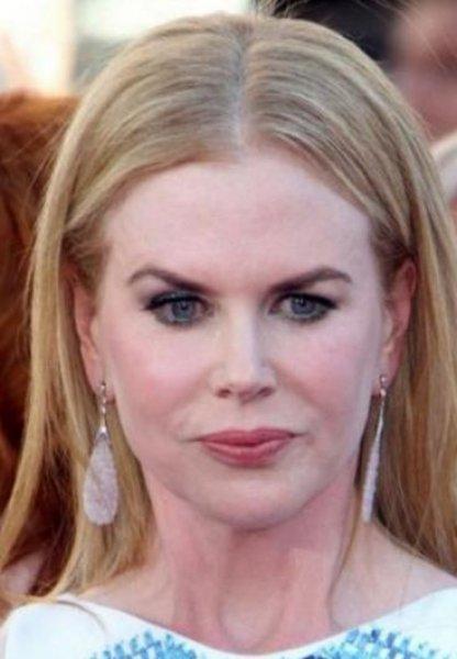 Estetik faciası ünlüler