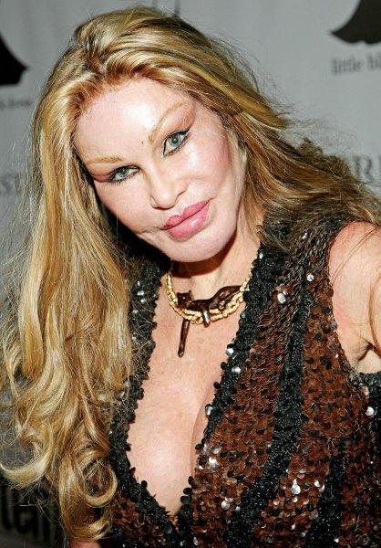 Estetik faciası ünlüler