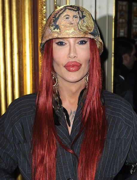 Estetik faciası ünlüler