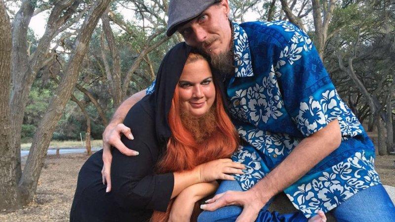 Dünyanın en ilginç çifti: Sakallı kadın ve yengeç adam