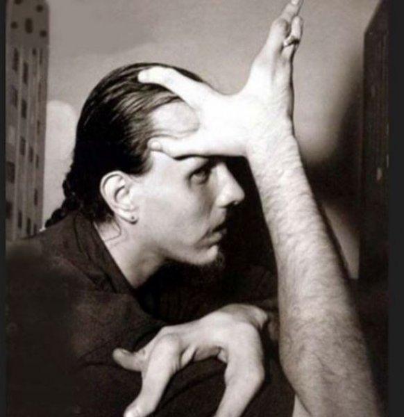 Dünyanın en ilginç çifti: Sakallı kadın ve yengeç adam