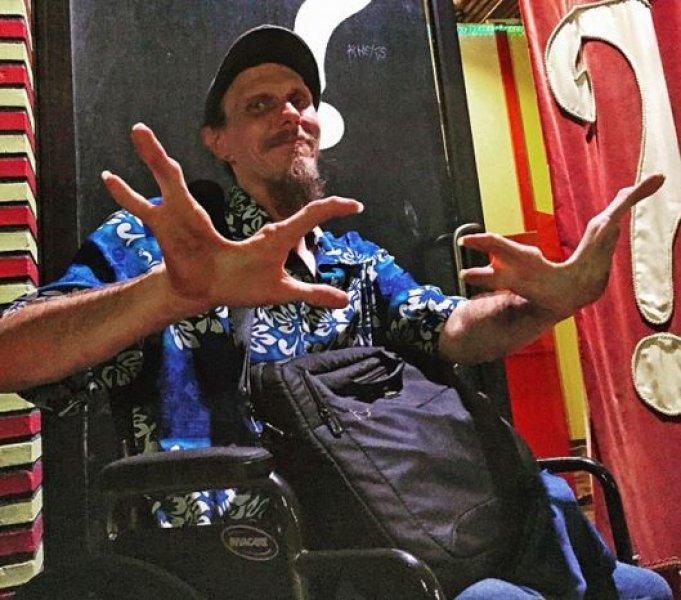 Dünyanın en ilginç çifti: Sakallı kadın ve yengeç adam