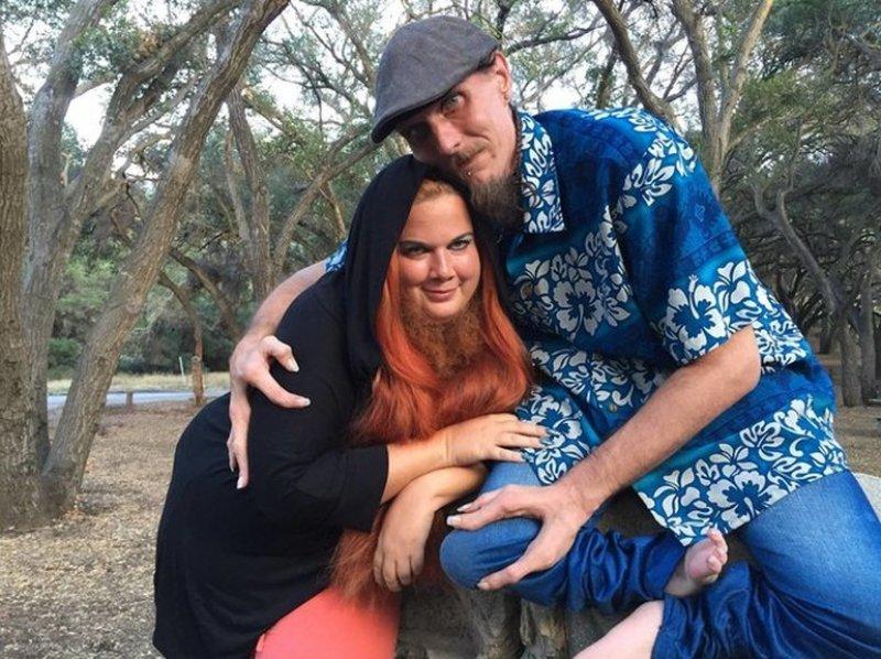 Dünyanın en ilginç çifti: Sakallı kadın ve yengeç adam