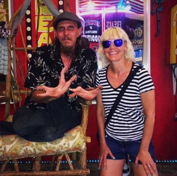 Dünyanın en ilginç çifti: Sakallı kadın ve yengeç adam