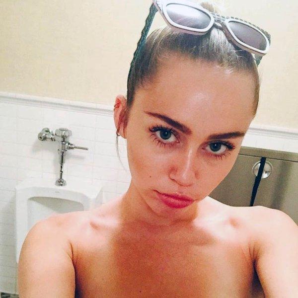 Miley Cyrus’a kedi saldırdı