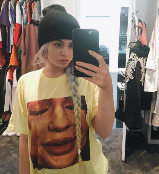 Estetik sonrası Kylie Jenner'ın değişimi 