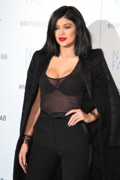 Estetik sonrası Kylie Jenner'ın değişimi 