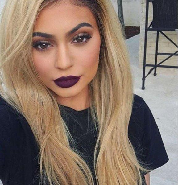 Estetik sonrası Kylie Jenner'ın değişimi 