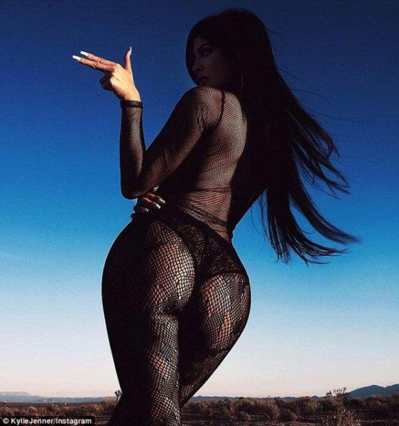 Estetik sonrası Kylie Jenner'ın değişimi 