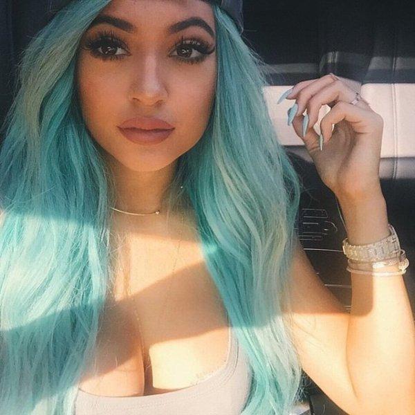 Estetik sonrası Kylie Jenner'ın değişimi 