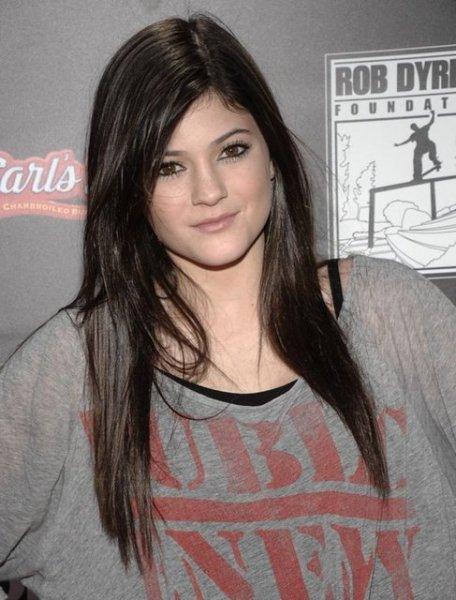 Estetik sonrası Kylie Jenner'ın değişimi 