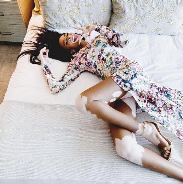 Winnie Harlow'dan Michael Jackson isyanı