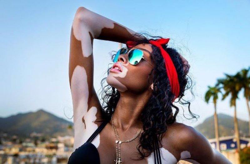 Winnie Harlow'dan Michael Jackson isyanı