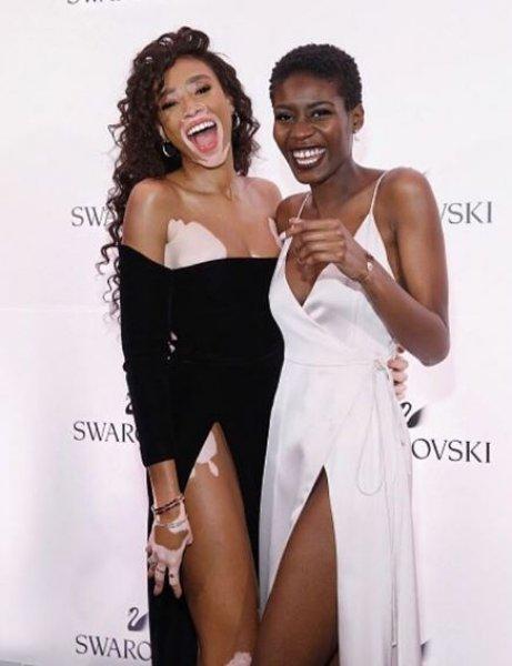 Winnie Harlow'dan Michael Jackson isyanı