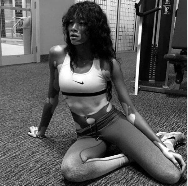 Winnie Harlow'dan Michael Jackson isyanı