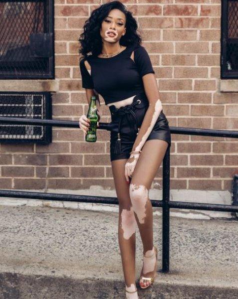 Winnie Harlow'dan Michael Jackson isyanı