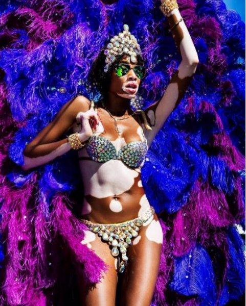 Winnie Harlow'dan Michael Jackson isyanı