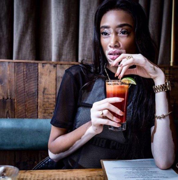 Winnie Harlow'dan Michael Jackson isyanı