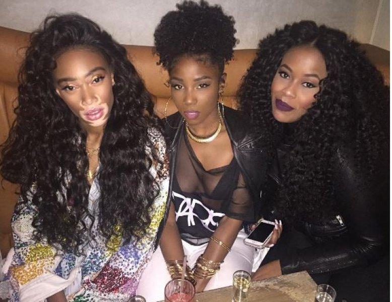 Winnie Harlow'dan Michael Jackson isyanı