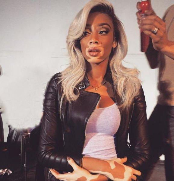 Winnie Harlow'dan Michael Jackson isyanı