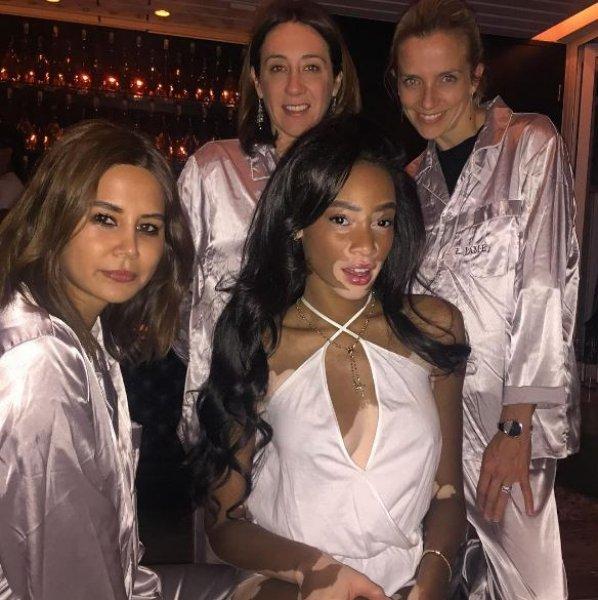 Winnie Harlow'dan Michael Jackson isyanı