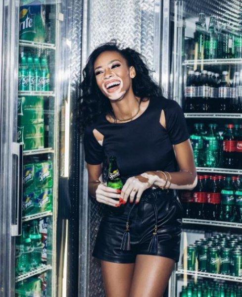 Winnie Harlow'dan Michael Jackson isyanı