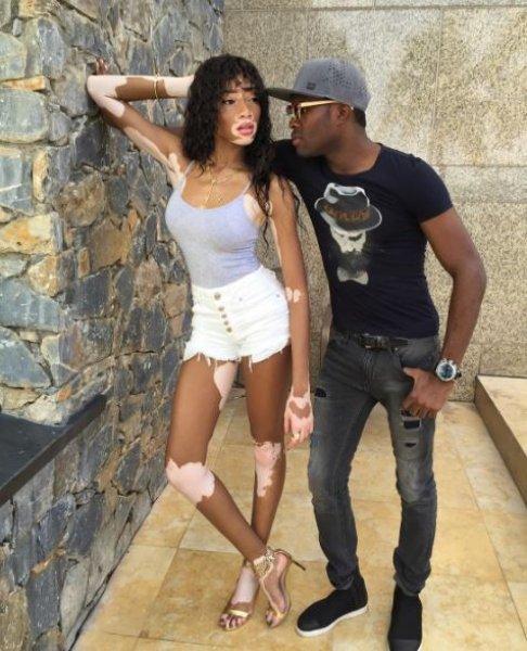 Winnie Harlow'dan Michael Jackson isyanı