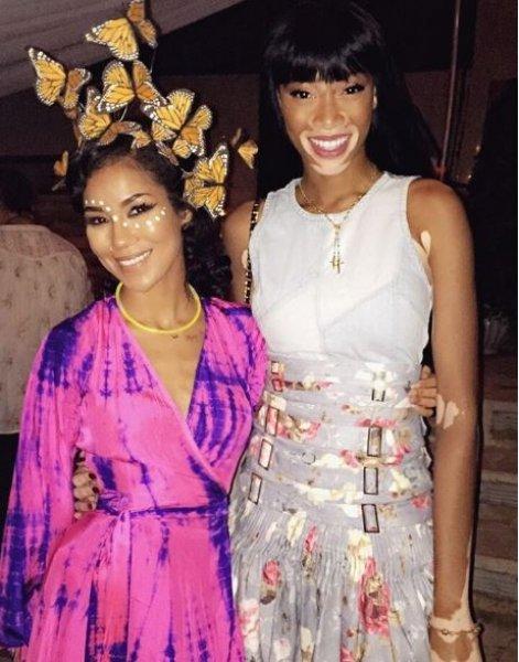 Winnie Harlow'dan Michael Jackson isyanı