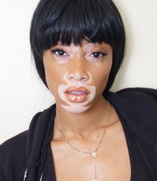 Winnie Harlow'dan Michael Jackson isyanı