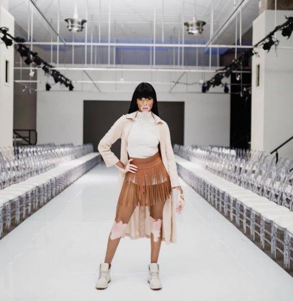 Winnie Harlow'dan Michael Jackson isyanı