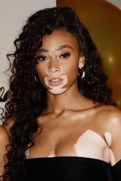 Winnie Harlow'dan Michael Jackson isyanı