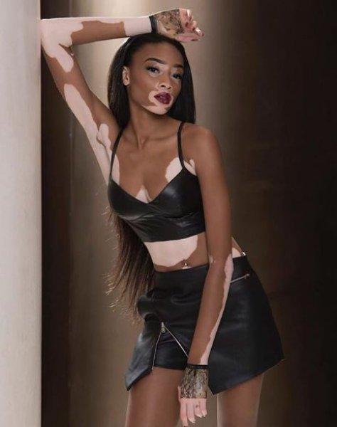 Winnie Harlow'dan Michael Jackson isyanı