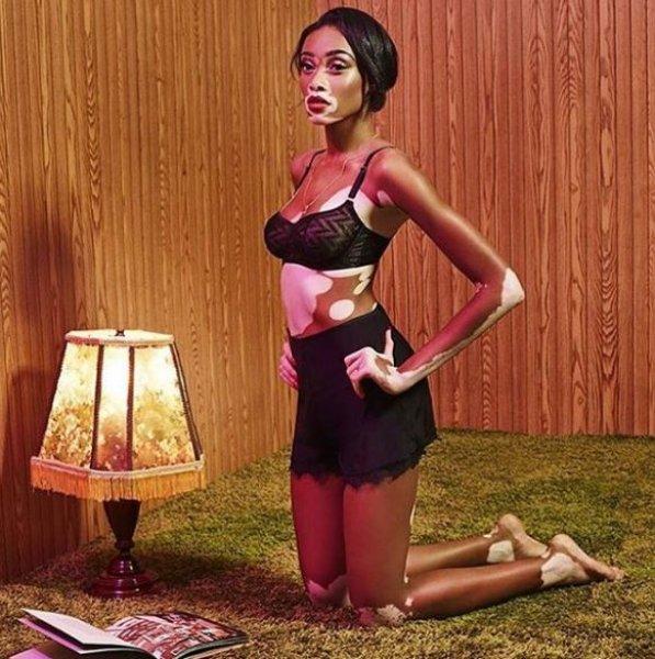 Winnie Harlow'dan Michael Jackson isyanı