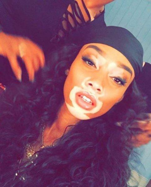 Winnie Harlow'dan Michael Jackson isyanı