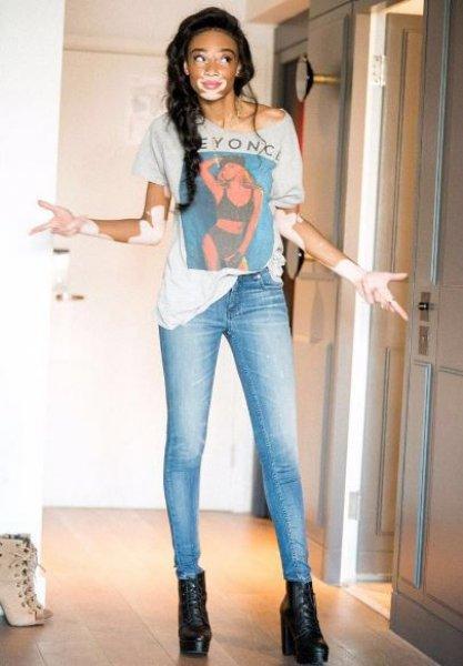 Winnie Harlow'dan Michael Jackson isyanı