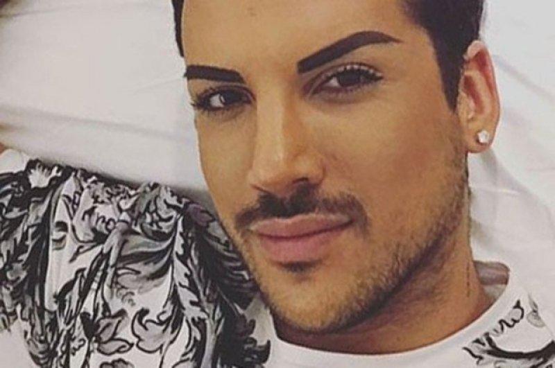 Kerimcan Durmaz'ın estetiksiz hali