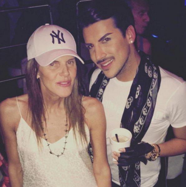 Kerimcan Durmaz'ın estetiksiz hali