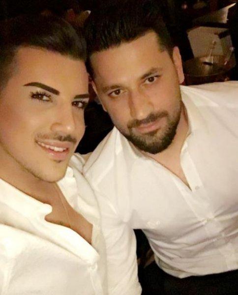 Kerimcan Durmaz'ın estetiksiz hali