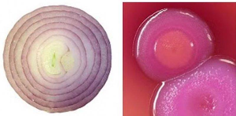 Meyve ve sebzelerin benzediği organlar 